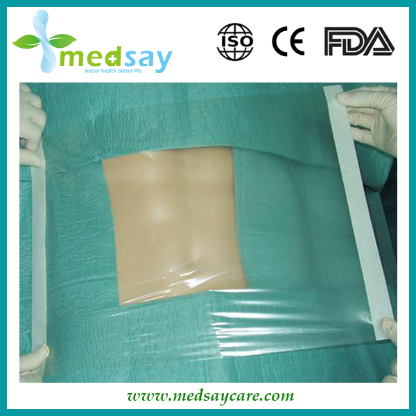 PU transparent surgical film (Incision drape)